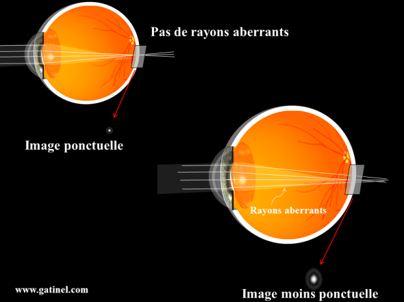 aberrations optiques