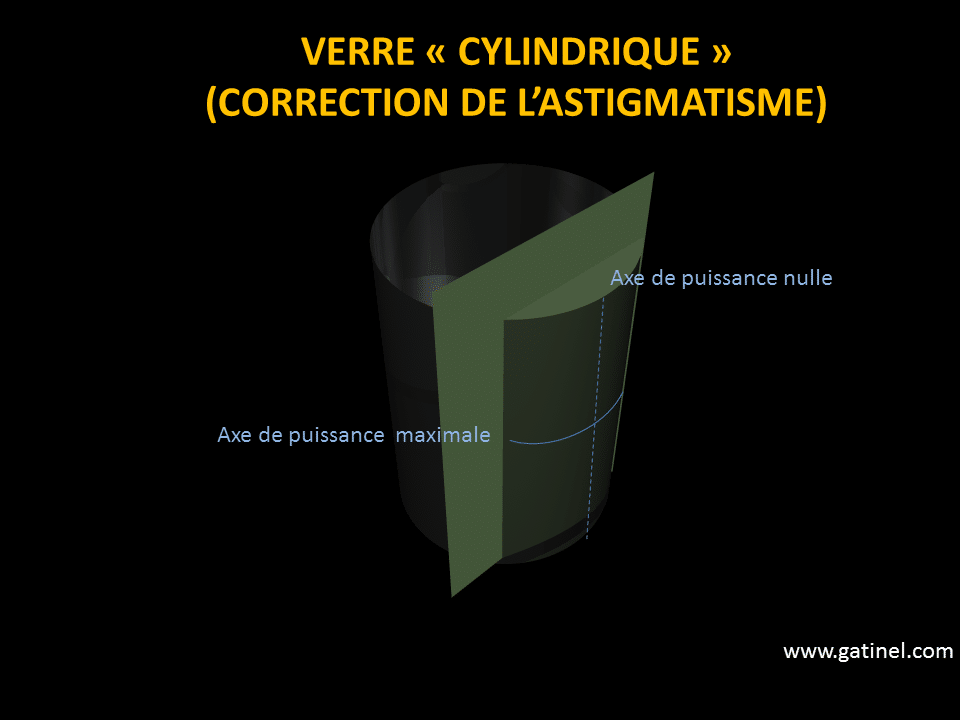 modele de myopie en 5 lettres