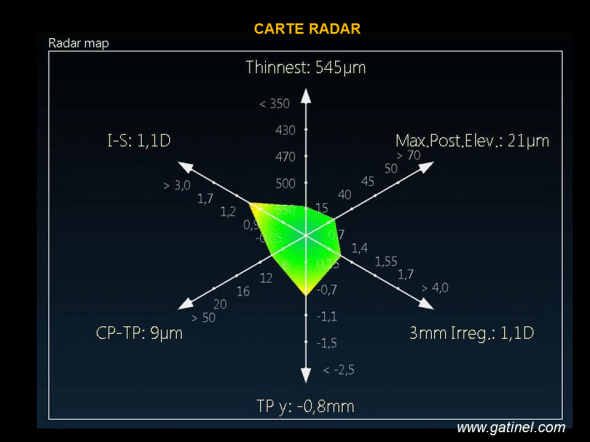 carte radar