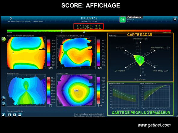 Score Analyzer