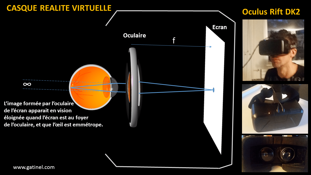 Casque de réalité virtuelle - Docteur Damien Gatinel