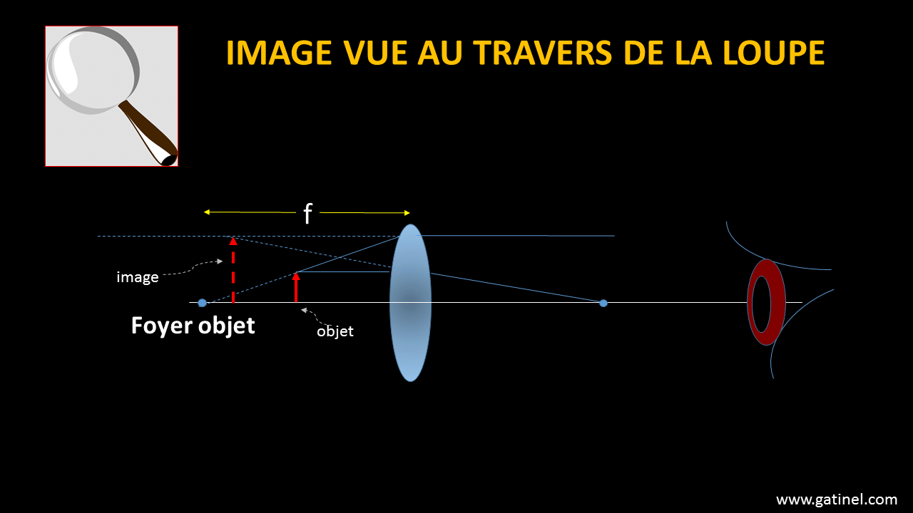 Loupe, grossissement - Docteur Damien Gatinel