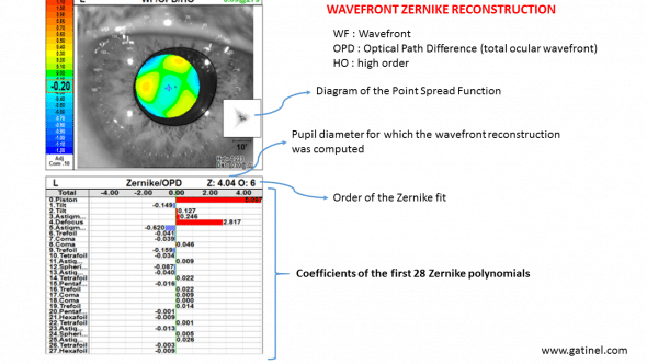 The wavefront sensor acquires optical data using a rotative slit and an automated skiascopy. 