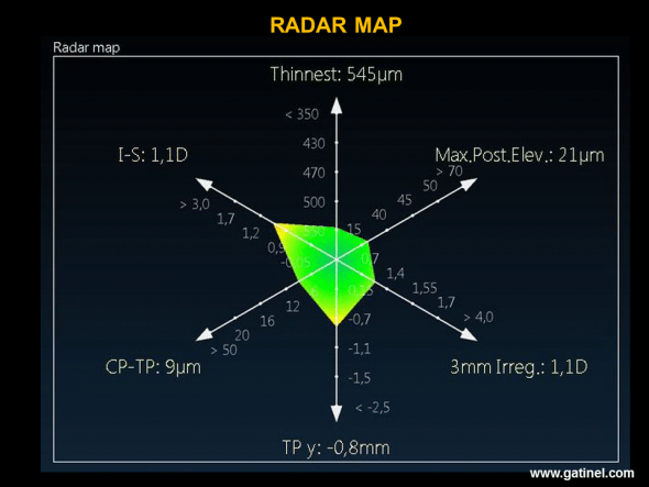 The Radar map visualizes the position of certain indices used in the score function: the presence of an abnormally high value is indicated by the use of a warm colour (yellow, orange, red): in this example, vertical decentration of the thinnest point and the value of the I-S index are situated about 2 standard deviations beyond the mean. 