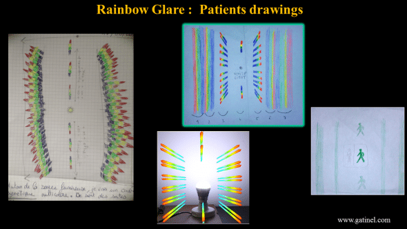 visual symptoms rainbow glare