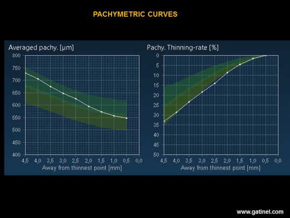 The average pachymetry map (Average pachy.) corresponds to the mean value of corneal thickness in 9 concentric rings (width: 0.5 mm) distributed from the thinnest point to the periphery of the cornea. The thinning rate map (Pachy. Thinning rate), expressed as a percentage, represents the thinning rate from the periphery to the centre of the cornea. The higher the thinning rate (lowest curve on the graph), the greater is the likelihood of a subclinical form of keratoconus. In this example, it is remarkable that, despite a considerably greater thickness than the mean on each concentric ring, the thinning rate is much higher and is situated at the limit of the normal range. 