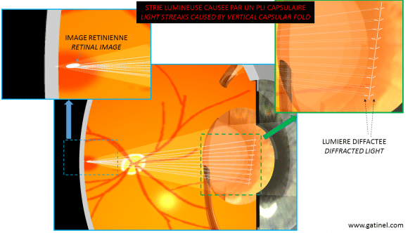 flap fold and light streak mechanism