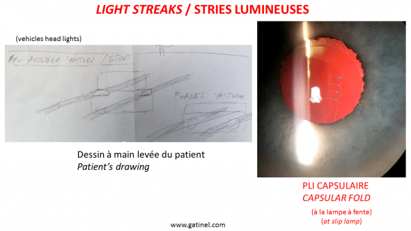 depiction of light streaks