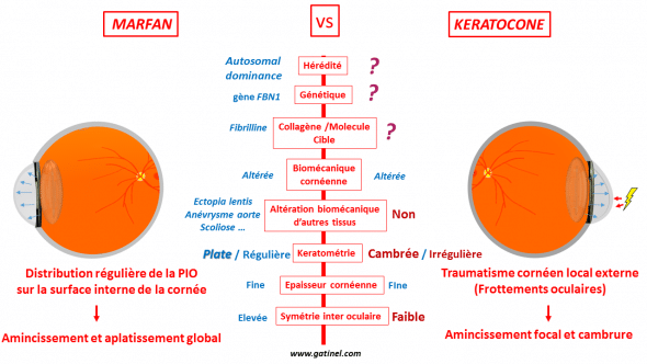 marfan vs keratocone