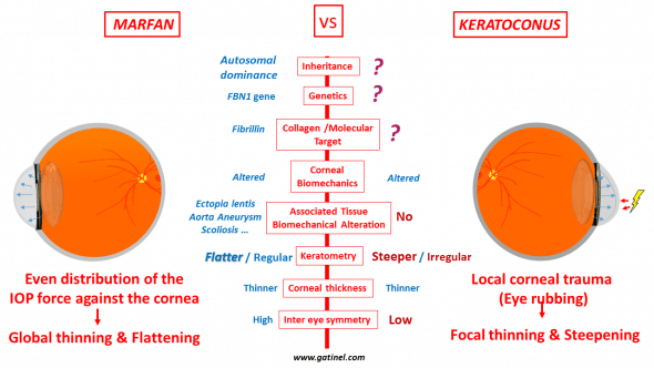 Marfan disease as an evidence of irrelevance of current theories about keratoconus genesis