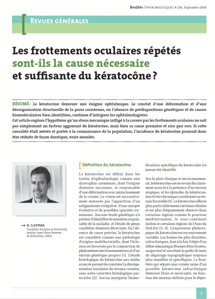 Kératocone et frottements oculaires Réalités Ophtalmologiques