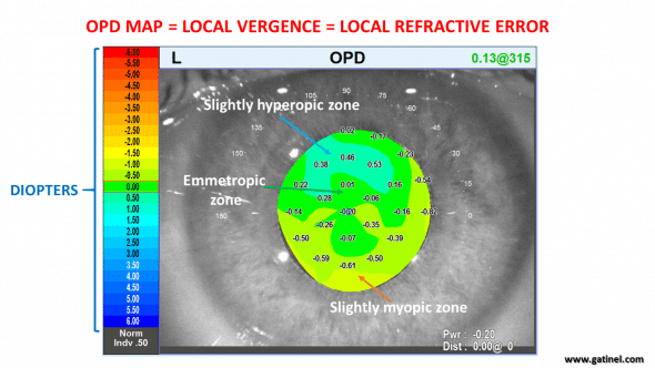 OPD amp, vergence map emmetropic eye