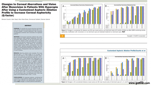 Figure 10 : Results extracted from a recent publication in the Journal of Refractive Surgery (1) reporting on the clinical results obtained when applying the presented nomogram for the LASIK correction of presbyopic hyperopic candidates. The attained binocular uncorrected visual acuity at near and far distances seem sufficient to provide operated patients with full spectacle independance for most of their daily and professionnal tasks. 