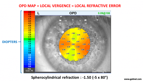 OPDmap, astigmatism