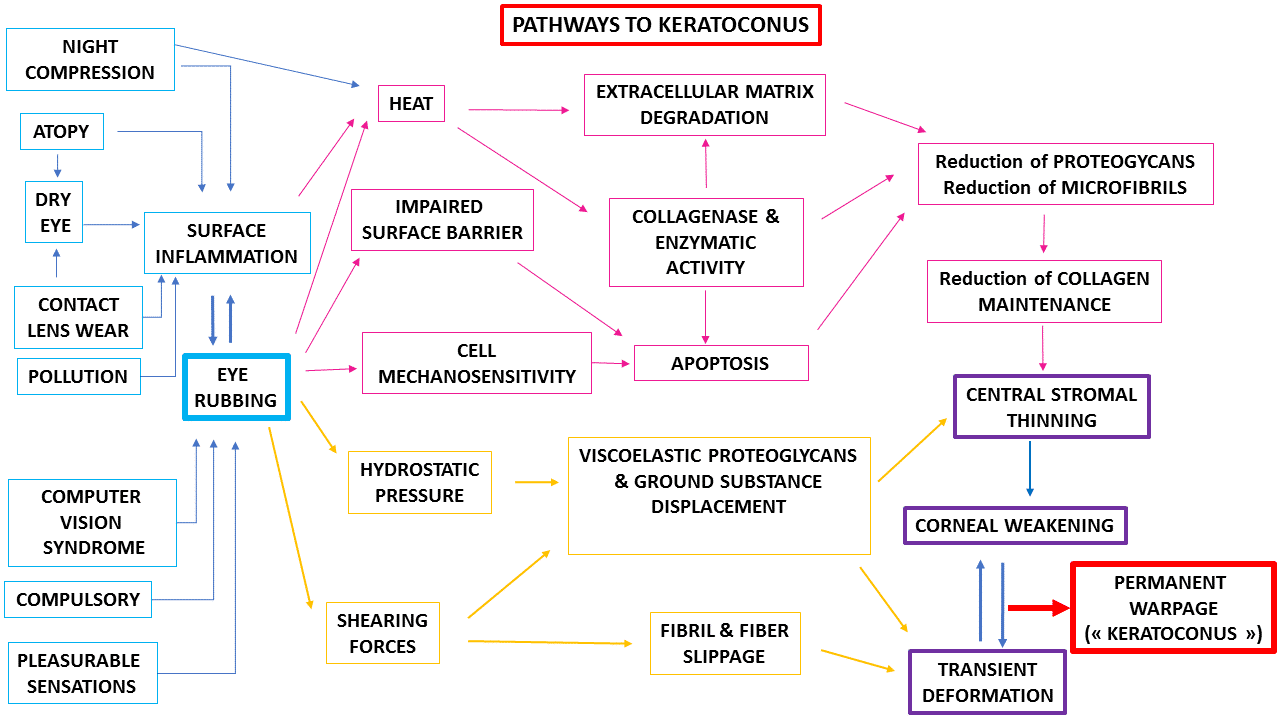 keratoconus patho genesis chart