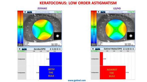 low order astigmatism : Zernike vs LD/HD