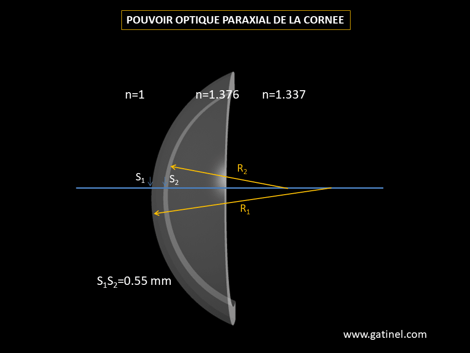 Réflexion sur miroirs courbes sphériques - Docteur Damien Gatinel