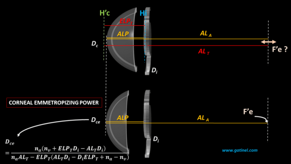 Corneal emmetropizing power diagram thick lens paraxial eye modeling