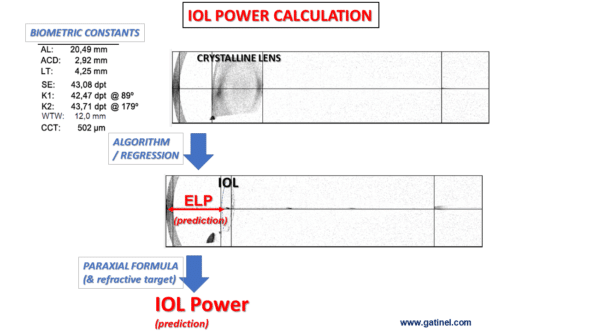 IOL power calculation using optical formula and ELP prediction