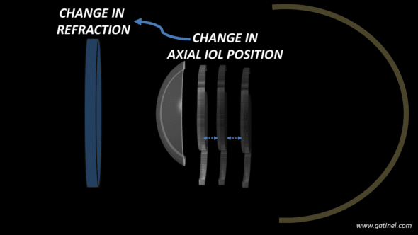 change in effective lens position vs change in refraction