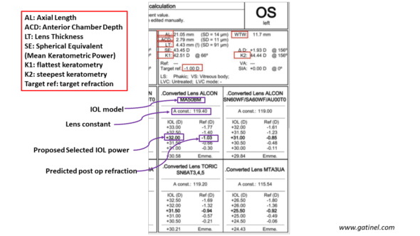 biometry report including lens ajustment constants