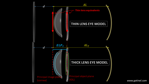 transforming thin lens pseudophakic eye model into thick lens model and defining the thin vx thick effective lens position