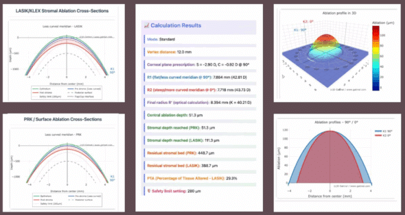 Corneal Thickness Simulator