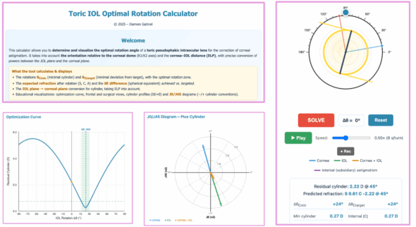 Toric IOL Optimal Rotation Calculator