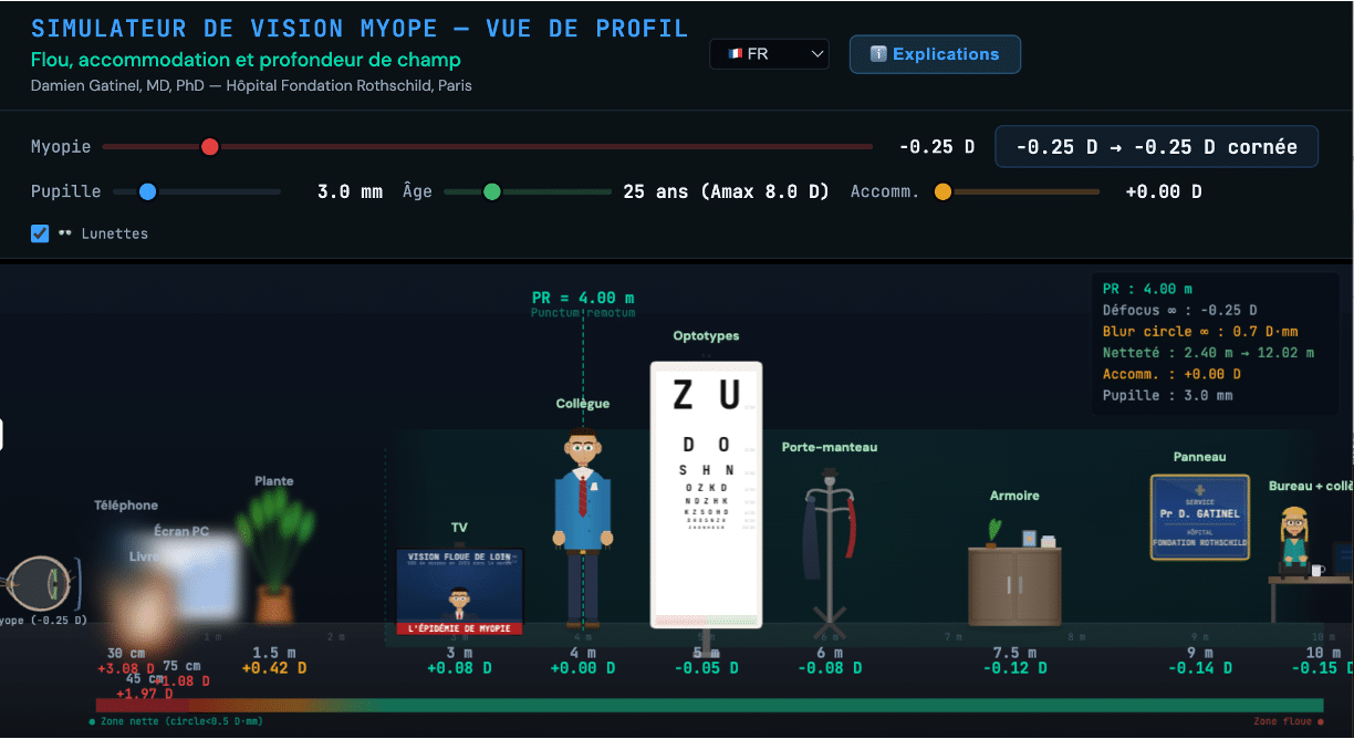 Simulateur de vision myope en vue de profil — Coupe sagittale, flou, accommodation et profondeur de champ
