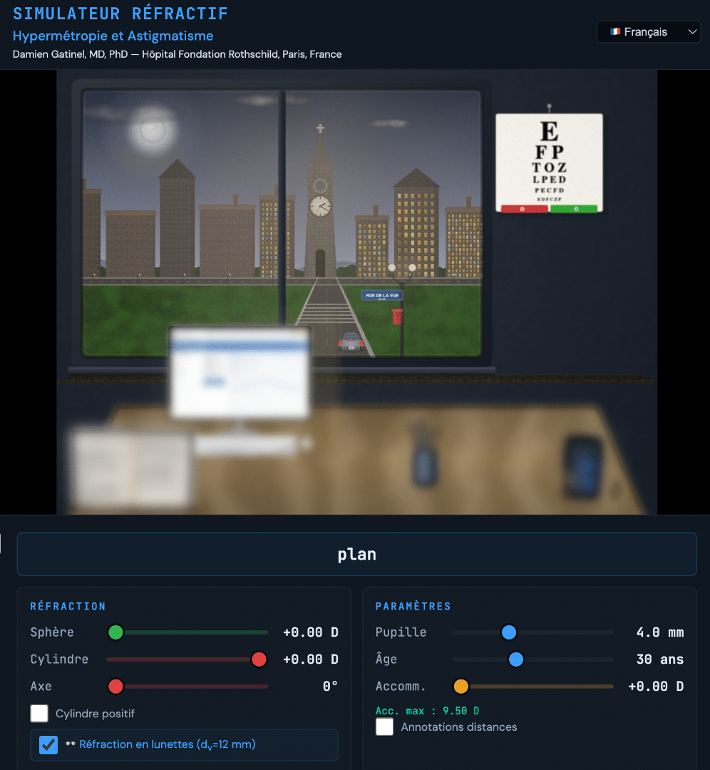 Simulateur de vision hypermétrope et astigmate — Simulation du flou visuel