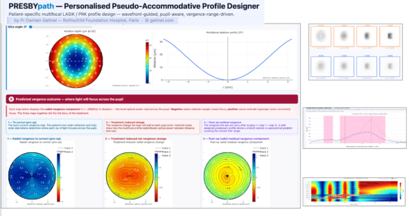 PRESBYpath by Damien Gatinel — Personalised presbyopic LASIK / PRK profile designer